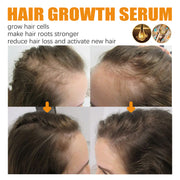 Biotin Hair Growth Spray Tough Hair Massage Scalp Dense Hair